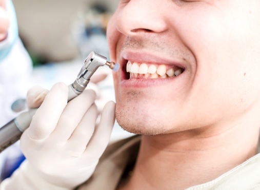 Teeth Cleaning: Assessment and Ongoing Care