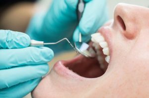 Managing Dental Costs Without Skipping Assessment